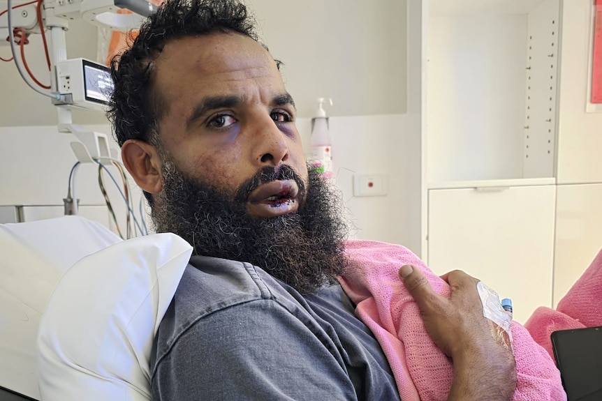 A photo of Samir in the hospital. His lip and eyes are bleeding and bruised.