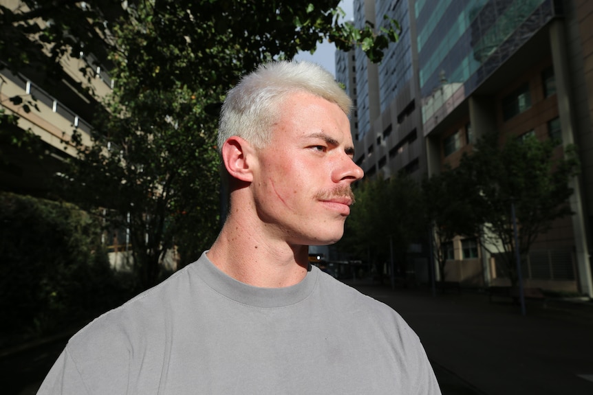 A young man with bleached hair and a scar on his cheek stands near a tree between tall buildings in a city.