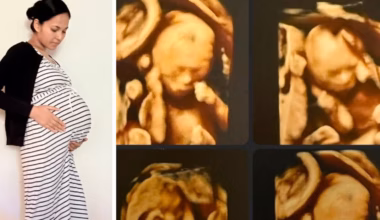 Identical quadruplets born at Royal Brisbane and Women’s Hospital