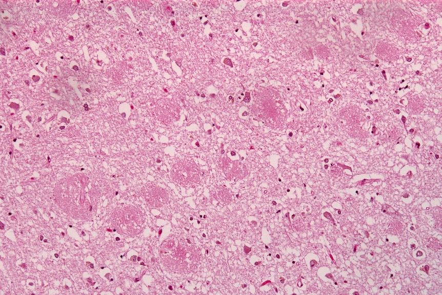 A pink pattern interspersed with dark spots and white patches