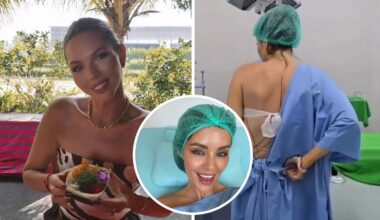 Bec Zacharia among ten influencers flown to Bali to undergo rib repositioning surgery