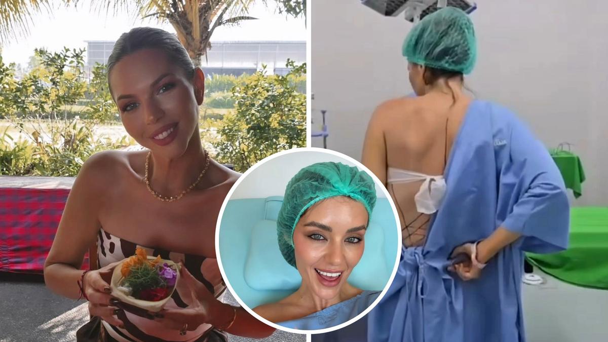 Bec Zacharia among ten influencers flown to Bali to undergo rib repositioning surgery