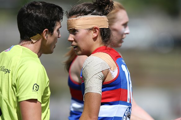 Libby Birch playing for the Western Bulldogs in 2018 with her head bandaged. She now plays for North Melbourne