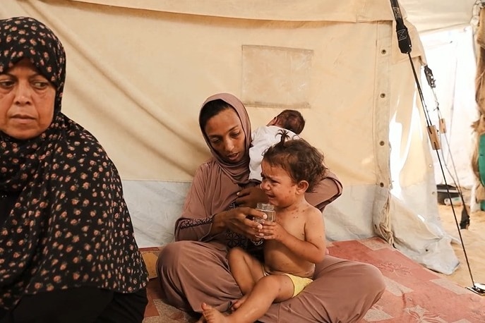 A toddler with chickenpox sits on her mother's lap with her grandmother nearby.
