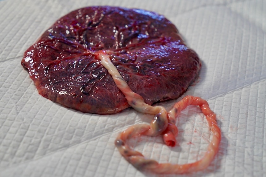 Placenta encapsulation