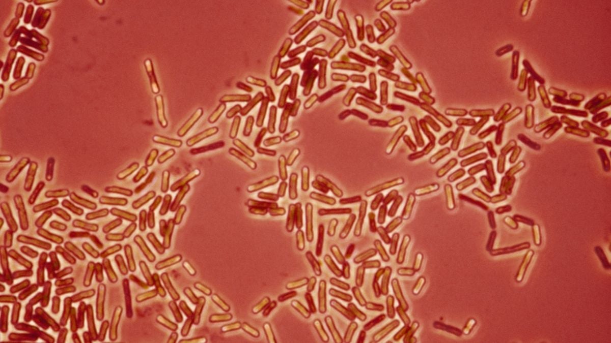 Drug-Resistant Bacteria May Be Jumping Between Pets And Humans, Scientists Warn : ScienceAlert