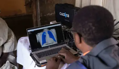 Unitaid and CHAI cut cost of AI screening software, unlocking affordable TB detection in communities without radiologists
