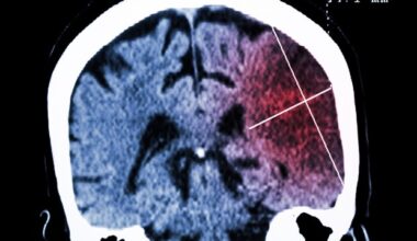 New viral insights lay foundation for treating infection with JC polyomaviruses
