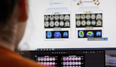 Canada’s Drug Agency reverses course, now recommends public drug plans cover Alzheimer’s drug