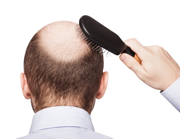 GLP-1 receptor agonists may increase hair loss risk