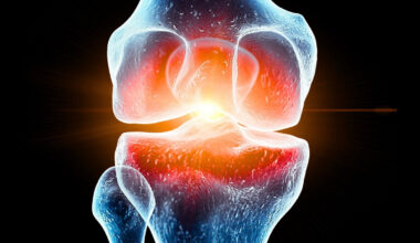 Spaceflight Seems to Damage Knee Cartilage, And Scientists May Have Found a Way to Protect It : ScienceAlert