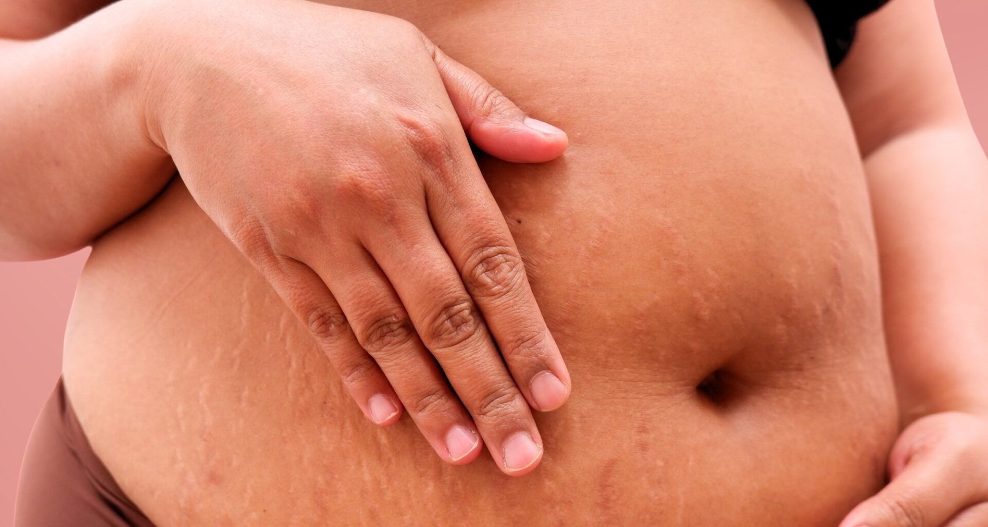 Study: Pregnancy outcomes following maternal GLP-1 receptor agonist exposure: a systematic review and meta-analysis. Image Credit: While of My Desk / Shutterstock