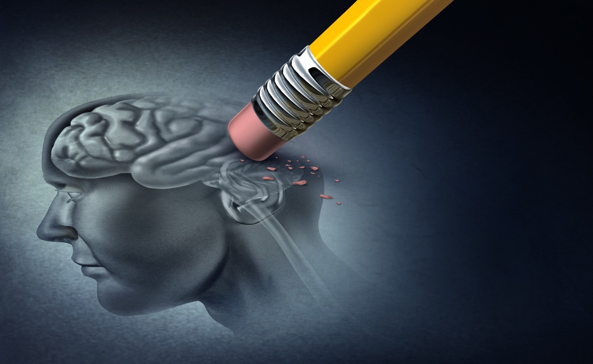 Perspective: Paddling into the unknown: young-onset Alzheimer’s. Image Credit: Lightspring / Shutterstock