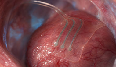 Study: Bioresorbable electrochemical sensors for continuous deep-tissue lactate monitoring in critical care. Image credit: AI-generated image created using ChatGPT/OpenAI