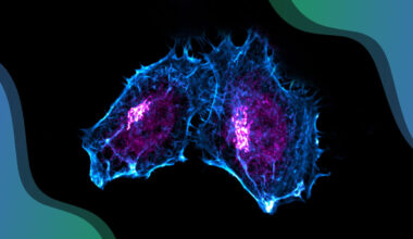 Fluorescence microscopy image of two adjacent cells outlined in blue, with bright magenta structures concentrated near their centers, set against a black background with teal and blue curved borders.