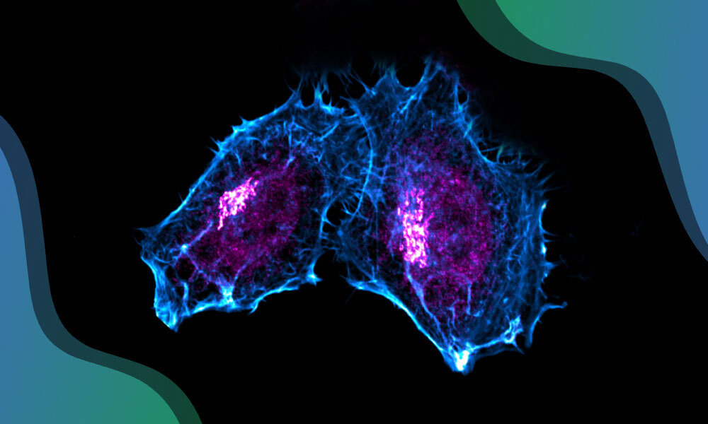 Fluorescence microscopy image of two adjacent cells outlined in blue, with bright magenta structures concentrated near their centers, set against a black background with teal and blue curved borders.