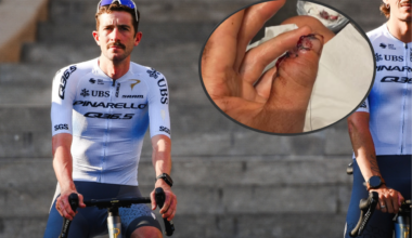 "On a positive note I am now 10g lighter #marginal gains": Pro out of Tour de France after losing part of thumb in crash; "Ridiculous" cycle lane shortened leaving cyclists stranded; Today's Tour stage ripe for a mountain ambush? + more on the live blog - Cycling News | Bike Reviews