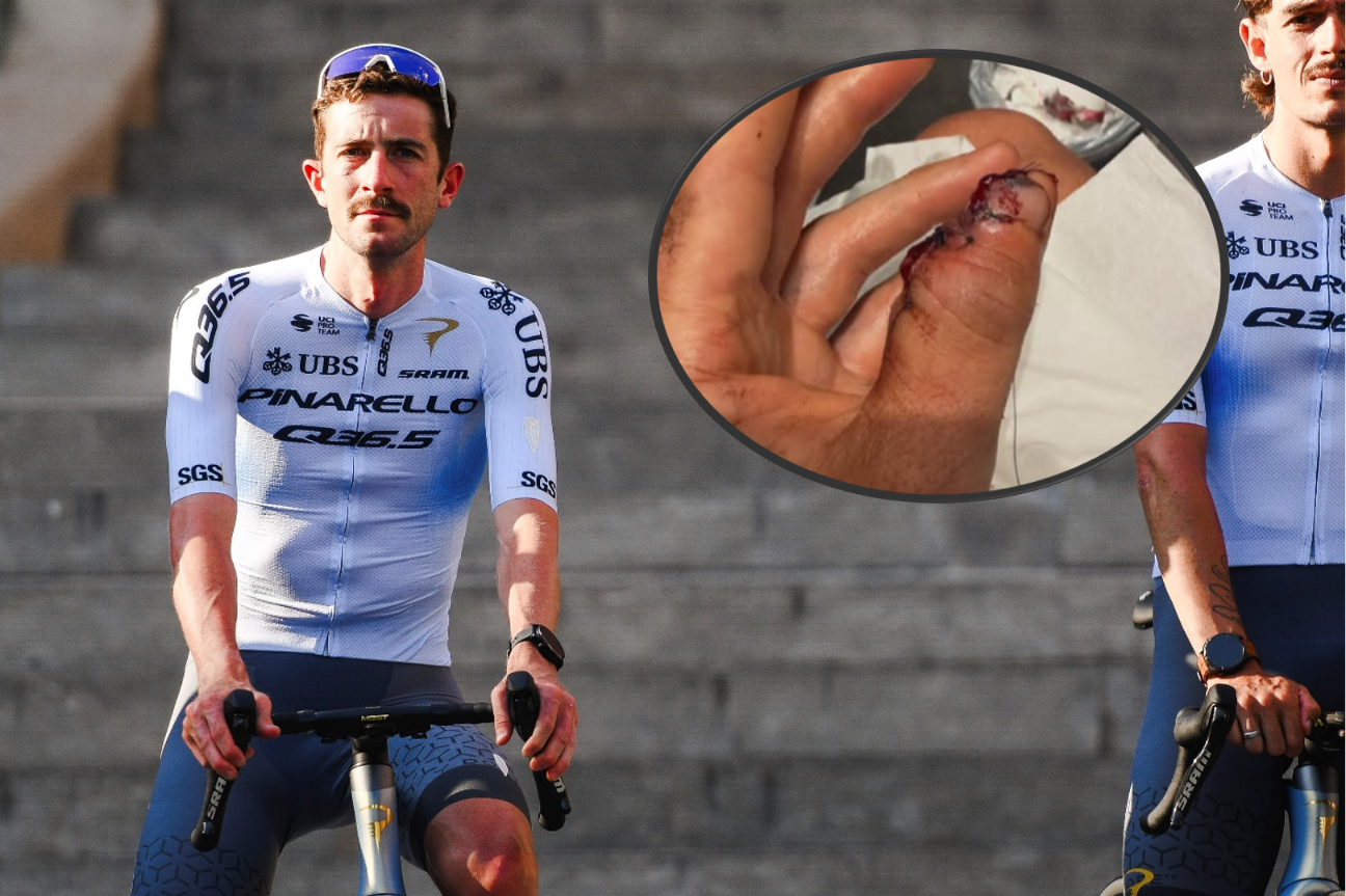 "On a positive note I am now 10g lighter #marginal gains": Pro out of Tour de France after losing part of thumb in crash; "Ridiculous" cycle lane shortened leaving cyclists stranded; Today's Tour stage ripe for a mountain ambush? + more on the live blog - Cycling News | Bike Reviews