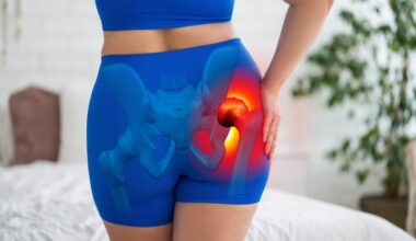 Woman Hip Dysplasia Joint Inflammation Osteoarthritis Pain