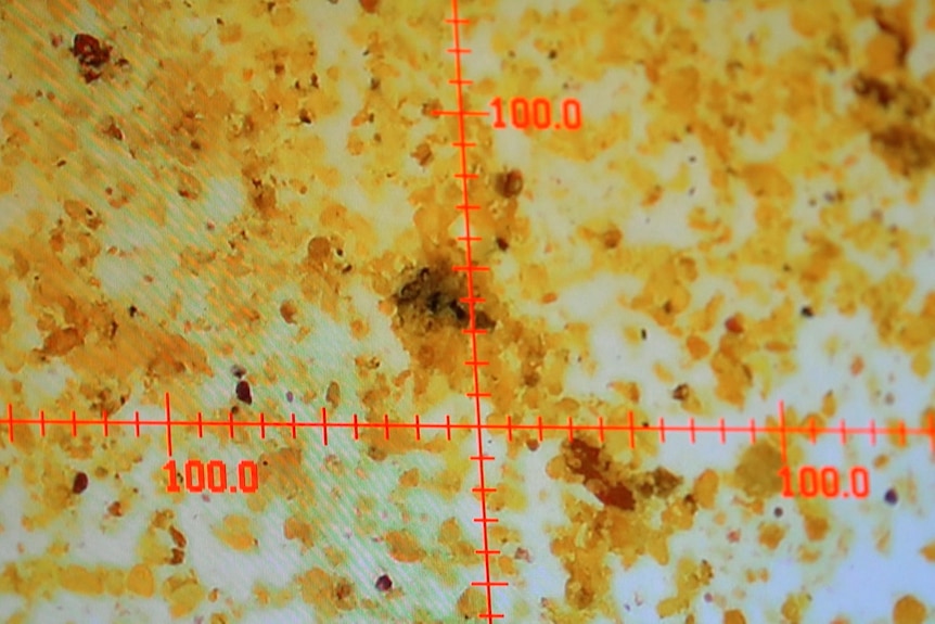 Turmeric viewed through a microscope.