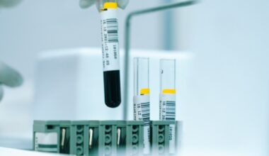 NHL CAR-T therapy market reaches $3.2b