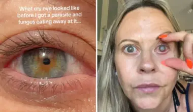 Emma Marsden: Lancashire woman may lose vision after parasite burrows into cornea