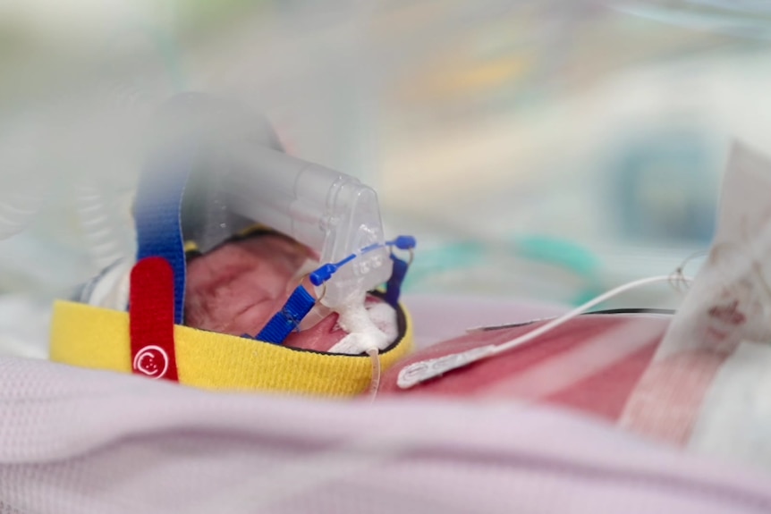 A premature baby in a crib with medical equipment attached