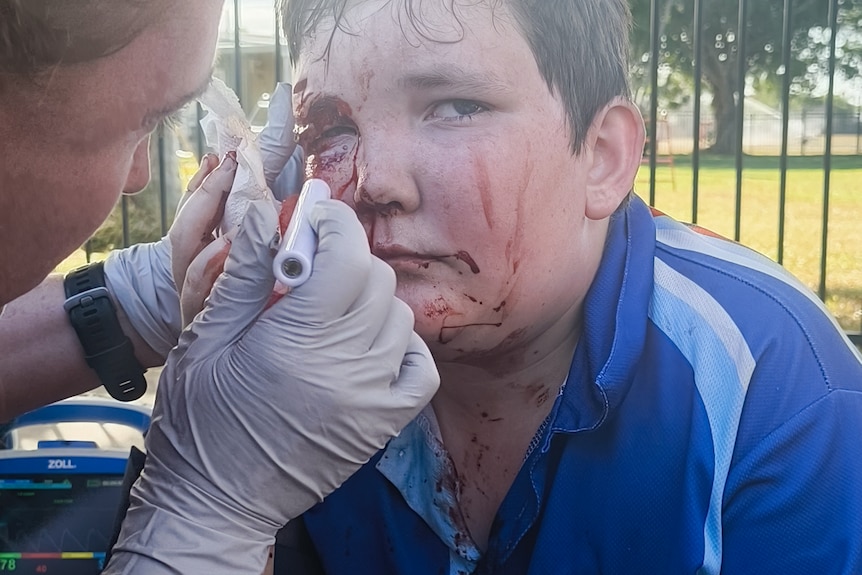 A young boy with an eye injury is examined by a health worker
