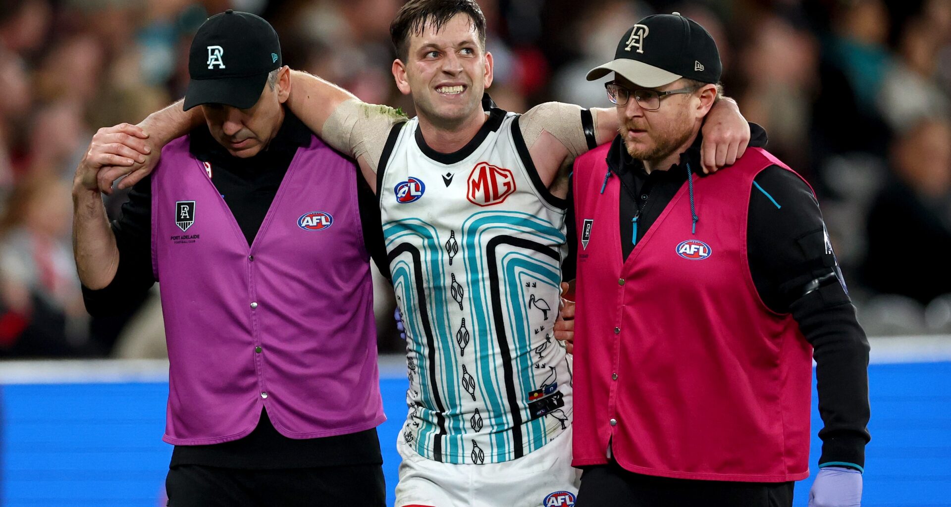 Butters could miraculously play again this year as scans reveal extent of ankle injury