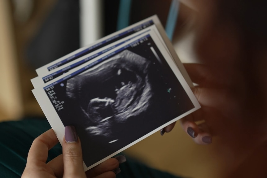 A woman holding ultrasound pictures of her baby in her hands.