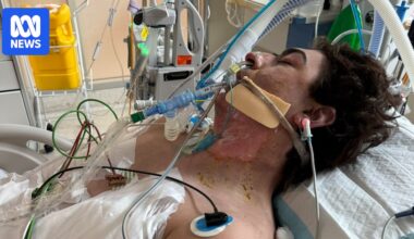 Perth man Lachie Perrem critically injured in robot vacuum fire