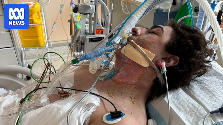 Perth man Lachie Perrem critically injured in robot vacuum fire