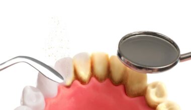 Cryo-EM helps identify the mechanisms of dental plaque formation