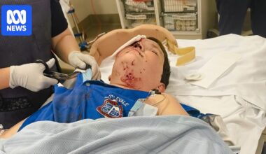 Townsville boy left with broken eye socket from e-scooter collision