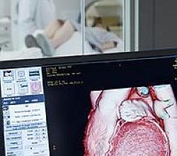 Atherosclerosis: Can AI help your doctor detect it?