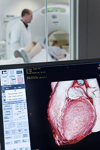 A computer monitor shows heart scan results, while visible through a window in the next room a doctor confers with the person who received the scan.