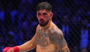 Ilia Topuria Shows Face After UFC Freedom 250 Loss