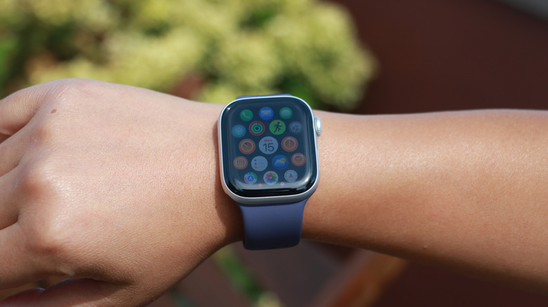 An Apple Watch Series 11.