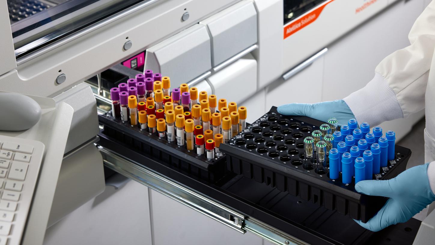 Siemens Healthineers Launches an Industry-leading Menu for Core Lab Capillary Testing on Atellica Analyzers with Claims for 24 Assays