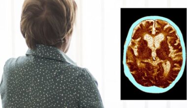 Dementia: Scientists identify physical change that could signal brain decline years before diagnosis