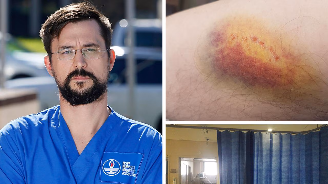 Nurses assaulted at work: The stats that should alarm all Australians