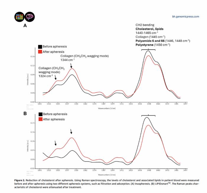 Reduction of cholesterol after apheresis.