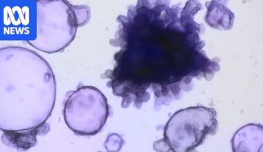Melbourne researchers create intestinal models to research inflammatory bowel disease