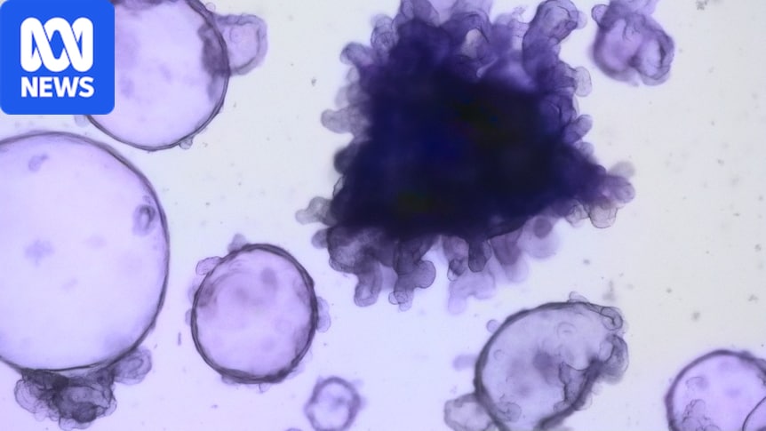 Melbourne researchers create intestinal models to research inflammatory bowel disease