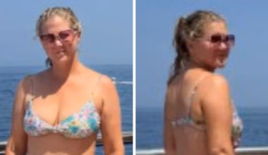 Bikini-clad Amy Schumer shows off dramatic weight loss in new unfiltered photos