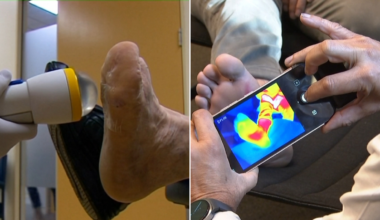 World-first artificial intelligence tool developed in Melbourne could save limbs of diabetics