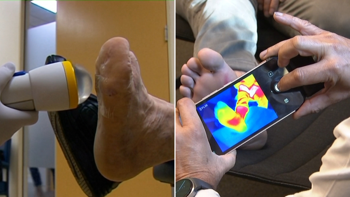 World-first artificial intelligence tool developed in Melbourne could save limbs of diabetics