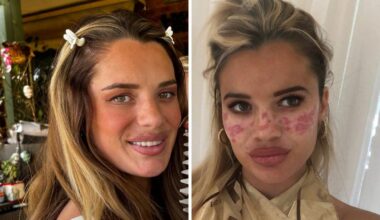 Influencer and TV personality Tilly Whitfield launches own line of tattoo freckle products after DIY horror