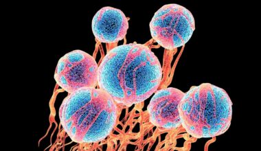 Common Sugar Appears to Loosen Cancer Cells And Help Them Spread : ScienceAlert