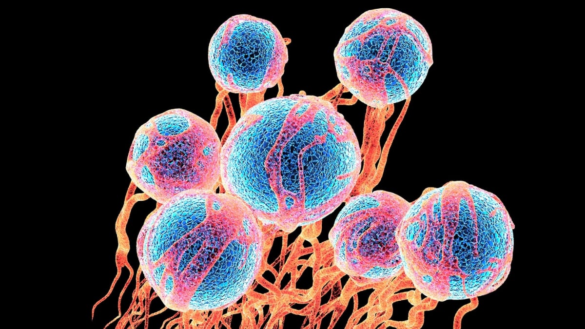 Common Sugar Appears to Loosen Cancer Cells And Help Them Spread : ScienceAlert